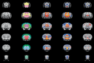 Grid of brain scans comparing mice with different genetic alterations.